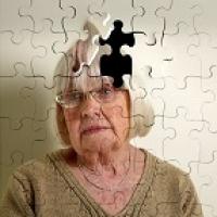 Что нужно знать о болезни Альцгеймера?